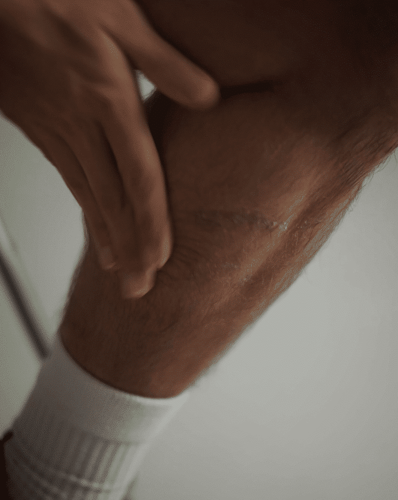 Kuit insmeren met de warmte creme.